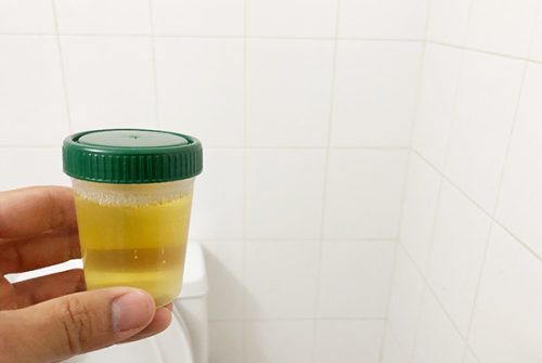 Essential tips to choose the best synthetic urine kit